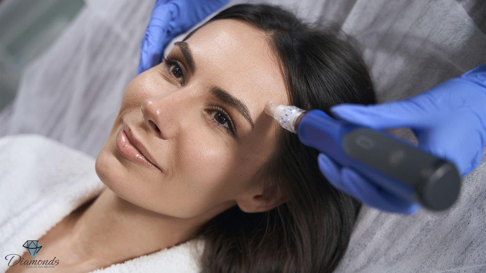 Microagulhamento: Clareador, Antiage, Antiacne, BB Glow e Olheiras